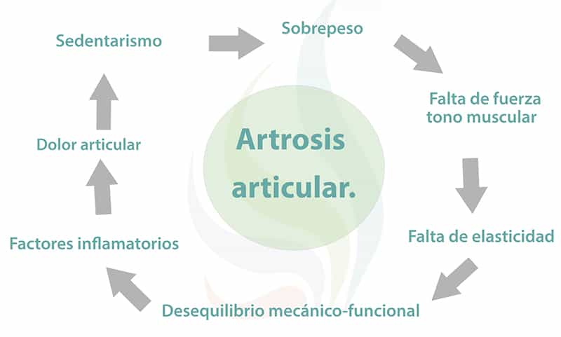 Artrosis articular - blog farmacia 24h - Farmacia 24 horas Palma | Farmacia Balanguera