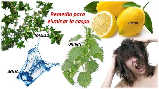 La caspa y la caida del cabello - blog farmacia 24h - Farmacia 24 horas Palma | Farmacia Balanguera