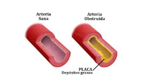 Riesgo cardiovascular - blog farmacia 24h - Farmacia 24 horas Palma | Farmacia Balanguera